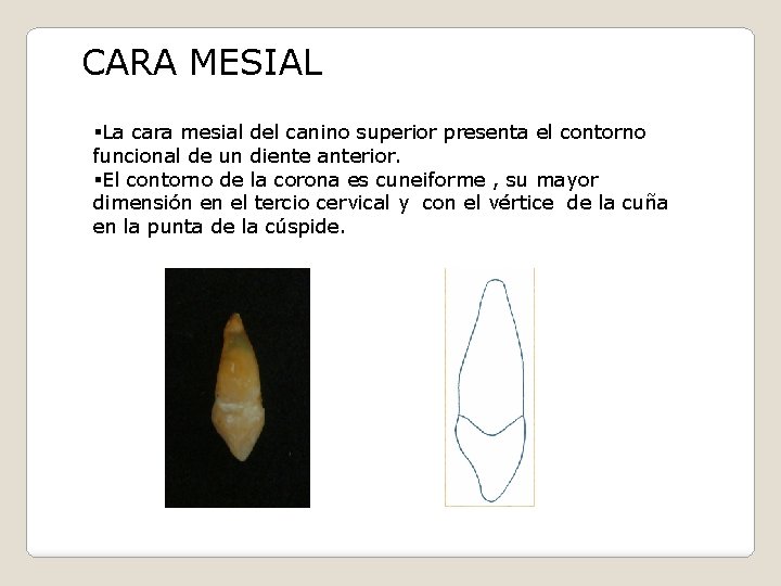 CARA MESIAL §La cara mesial del canino superior presenta el contorno funcional de un