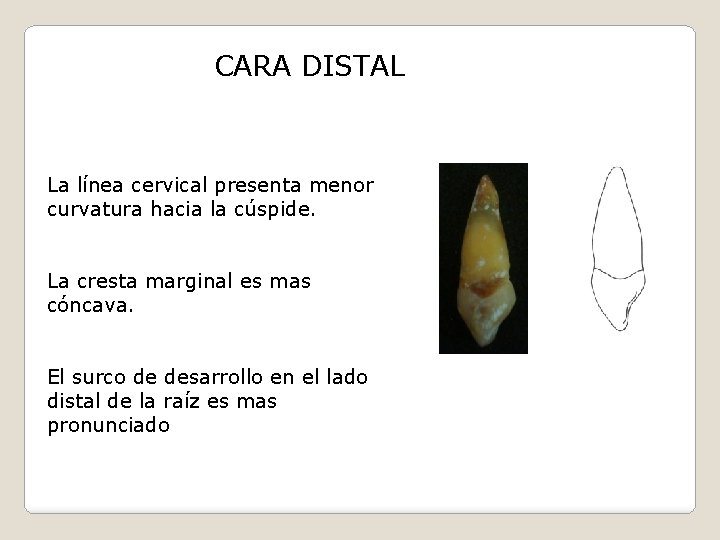 CARA DISTAL La línea cervical presenta menor curvatura hacia la cúspide. La cresta marginal