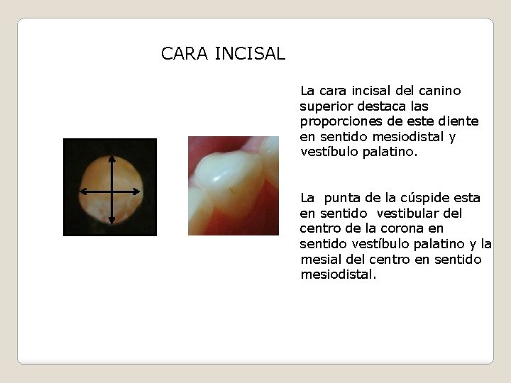 CARA INCISAL La cara incisal del canino superior destaca las proporciones de este diente