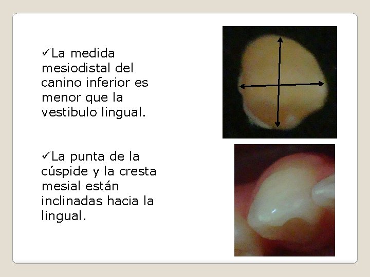 üLa medida mesiodistal del canino inferior es menor que la vestibulo lingual. üLa punta