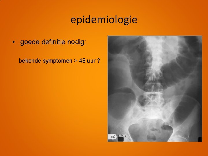 epidemiologie • goede definitie nodig: bekende symptomen > 48 uur ? 