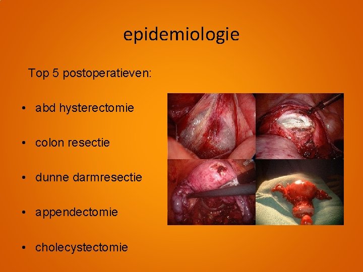 epidemiologie Top 5 postoperatieven: • abd hysterectomie • colon resectie • dunne darmresectie •