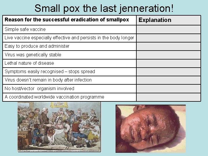 Small pox the last jenneration! Reason for the successful eradication of smallpox Simple safe