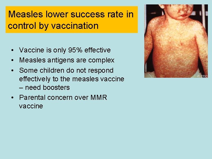 Measles lower success rate in control by vaccination • Vaccine is only 95% effective