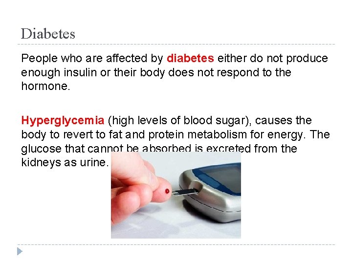 Diabetes People who are affected by diabetes either do not produce enough insulin or