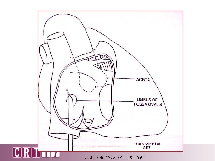 G. Joseph CCVD 42: 138, 1997 