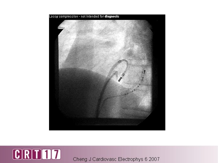 Cheng J Cardiovasc Electrophys 6 2007 