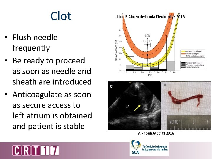 Clot • Flush needle frequently • Be ready to proceed as soon as needle