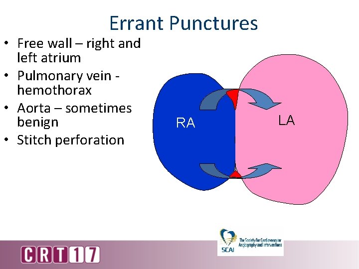 Errant Punctures • Free wall – right and left atrium • Pulmonary vein hemothorax