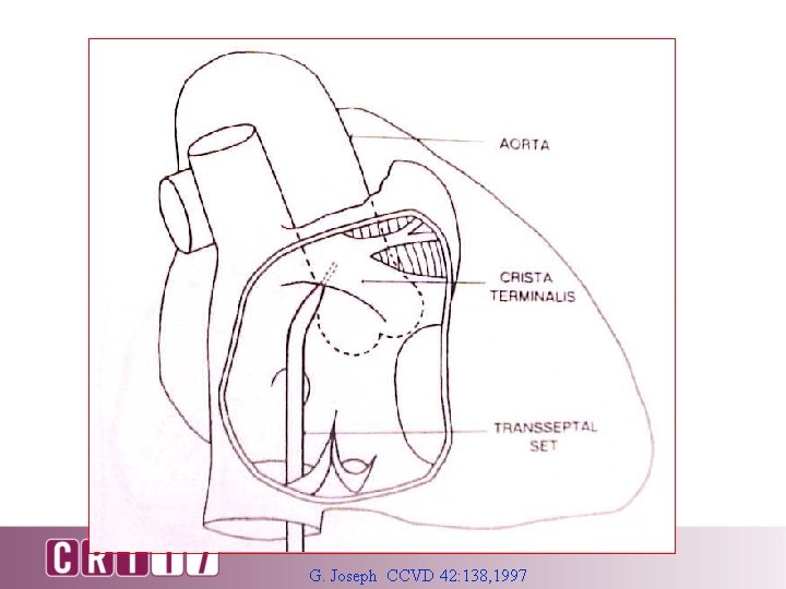G. Joseph CCVD 42: 138, 1997 