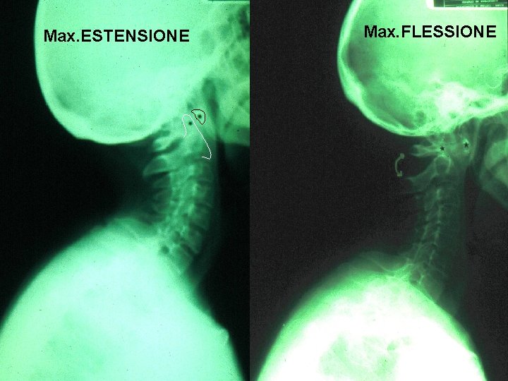 Max. ESTENSIONE Max. FLESSIONE 