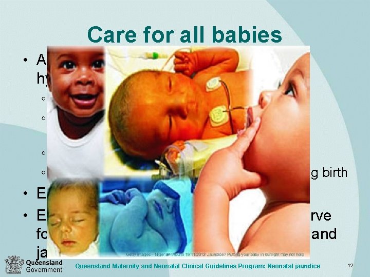 Care for all babies • Assess risk factors for significant hyperbilirubinaemia: ◦ Gestational age