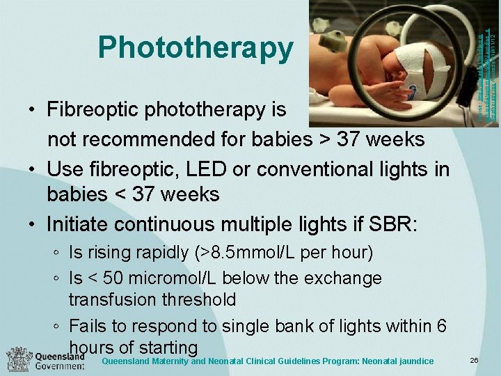  • Fibreoptic phototherapy is not recommended for babies > 37 weeks • Use