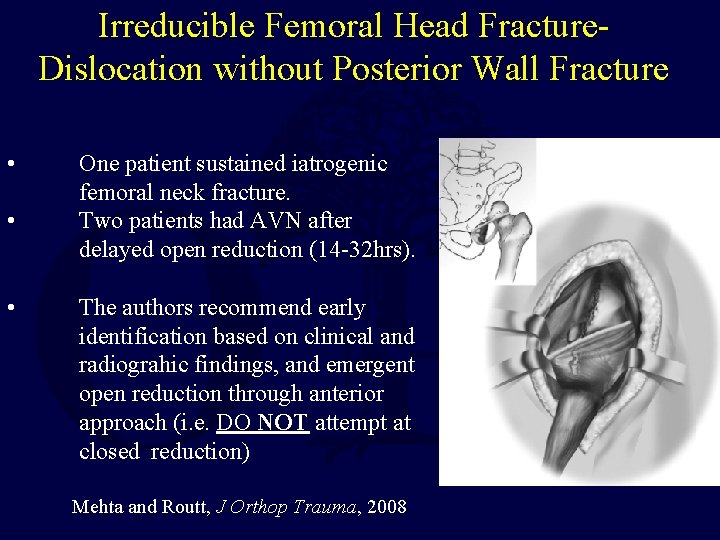 Irreducible Femoral Head Fracture. Dislocation without Posterior Wall Fracture • • • One patient