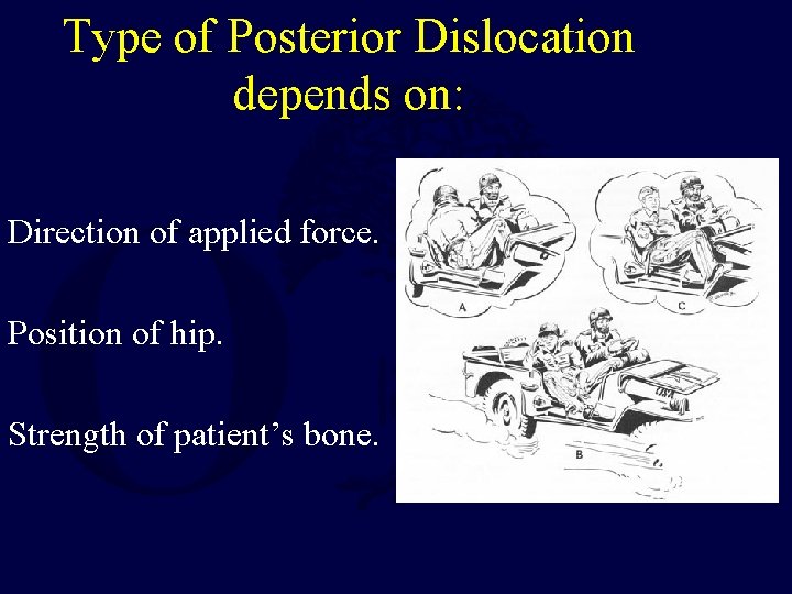 Type of Posterior Dislocation depends on: Direction of applied force. Position of hip. Strength