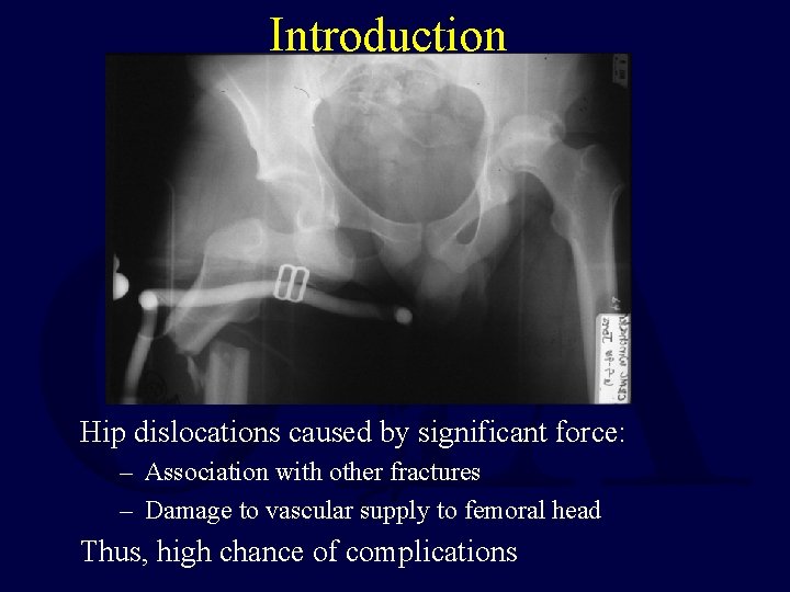 Introduction Hip dislocations caused by significant force: – Association with other fractures – Damage