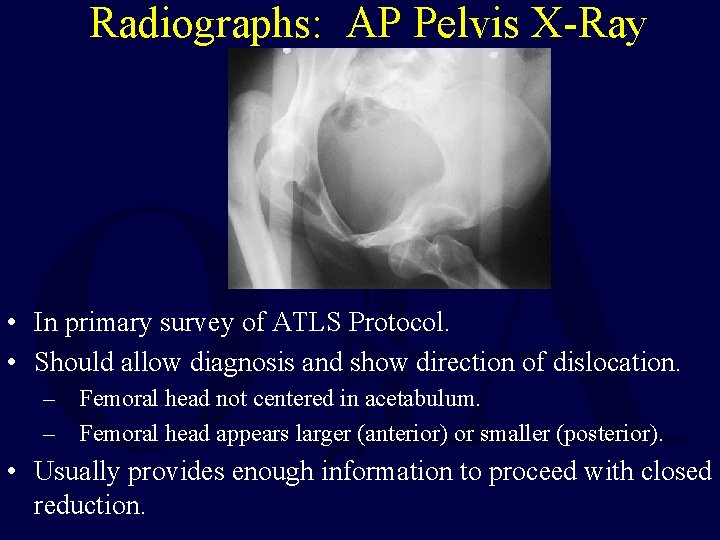 Radiographs: AP Pelvis X-Ray • In primary survey of ATLS Protocol. • Should allow