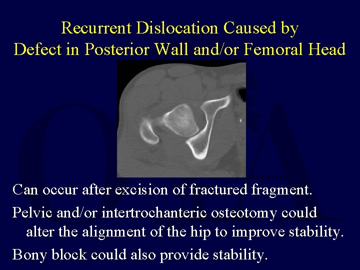 Recurrent Dislocation Caused by Defect in Posterior Wall and/or Femoral Head Can occur after
