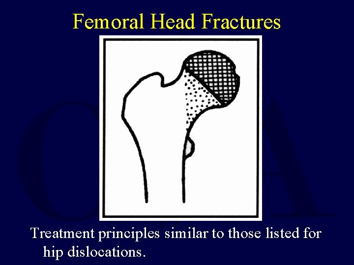Femoral Head Fractures Treatment principles similar to those listed for hip dislocations. 
