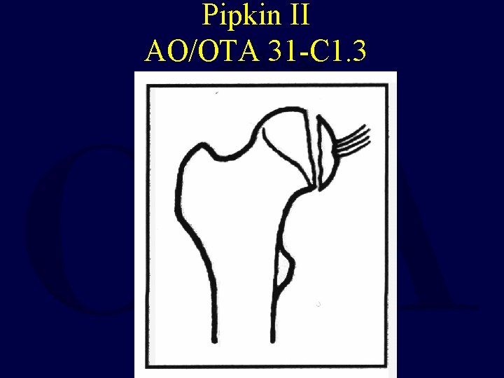 Pipkin II AO/OTA 31 -C 1. 3 