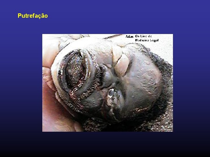 Putrefação 