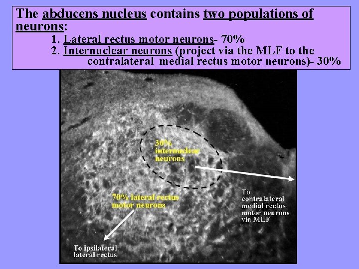 The abducens nucleus contains two populations of neurons: 1. Lateral rectus motor neurons- 70%