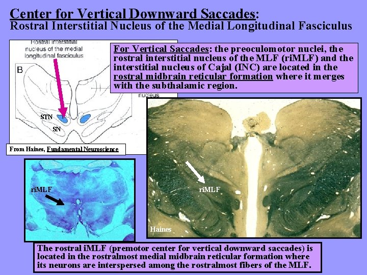 Center for Vertical Downward Saccades: Rostral Interstitial Nucleus of the Medial Longitudinal Fasciculus For