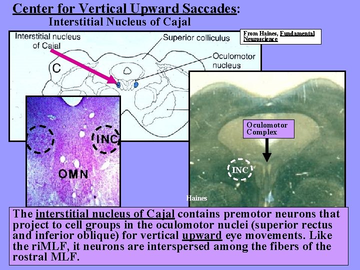 Center for Vertical Upward Saccades: Interstitial Nucleus of Cajal From Haines, Fundamental Neuroscience Oculomotor