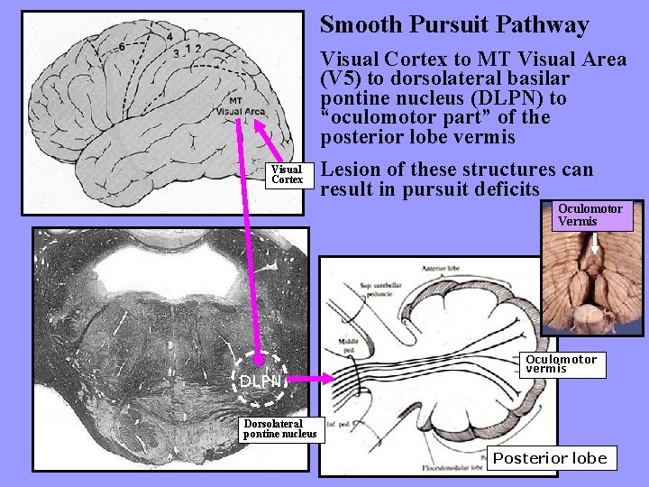 Smooth Pursuit Pathway Visual Cortex to MT Visual Area (V 5) to dorsolateral basilar