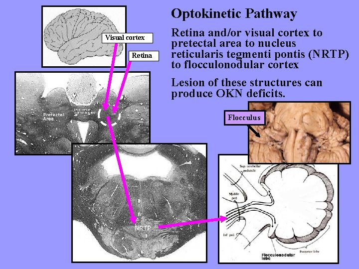 Optokinetic Pathway Visual cortex Retina and/or visual cortex to pretectal area to nucleus reticularis