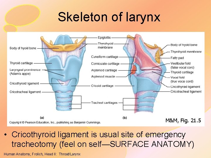 Skeleton of larynx M&M, Fig. 21. 5 • Cricothyroid ligament is usual site of