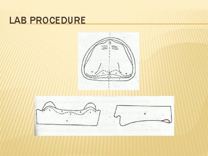 LAB PROCEDURE 