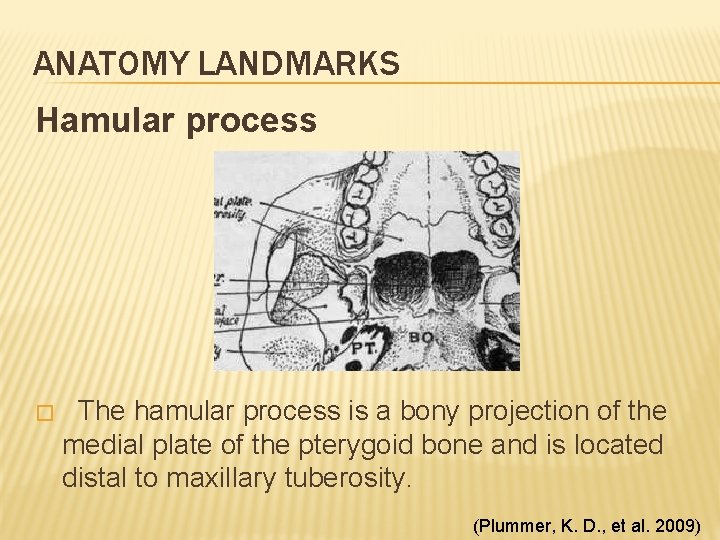 ANATOMY LANDMARKS Hamular process � The hamular process is a bony projection of the