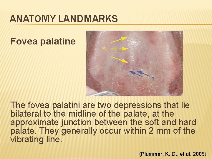 ANATOMY LANDMARKS Fovea palatine The fovea palatini are two depressions that lie bilateral to