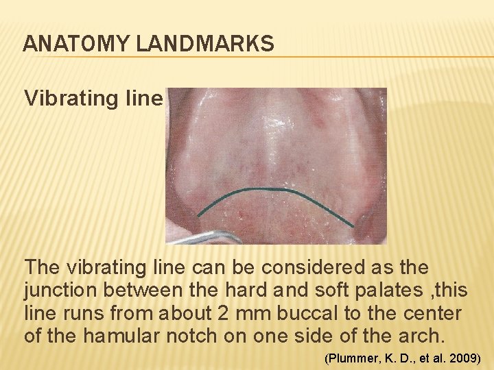 ANATOMY LANDMARKS Vibrating line The vibrating line can be considered as the junction between