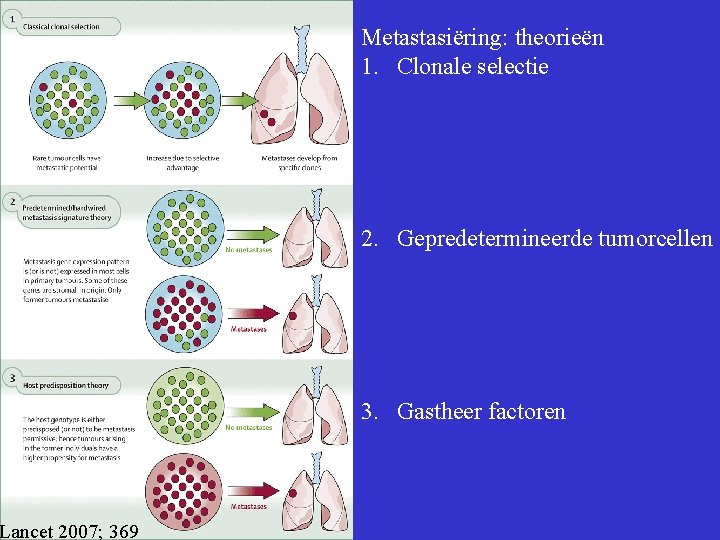 Lancet 2007; 369 Metastasiëring: theorieën 1. Clonale selectie 2. Gepredetermineerde tumorcellen 3. Gastheer factoren
