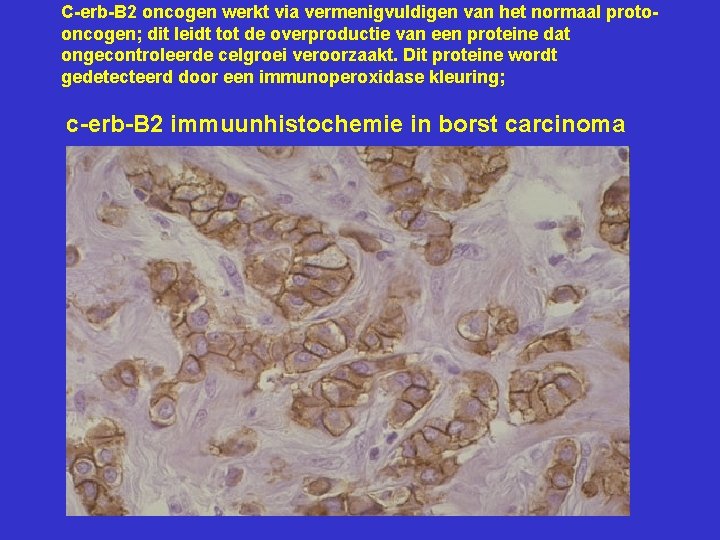 C-erb-B 2 oncogen werkt via vermenigvuldigen van het normaal protooncogen; dit leidt tot de