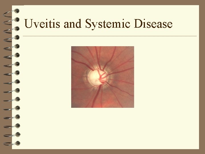 Uveitis and Systemic Disease Uveitis and Systemic Disease