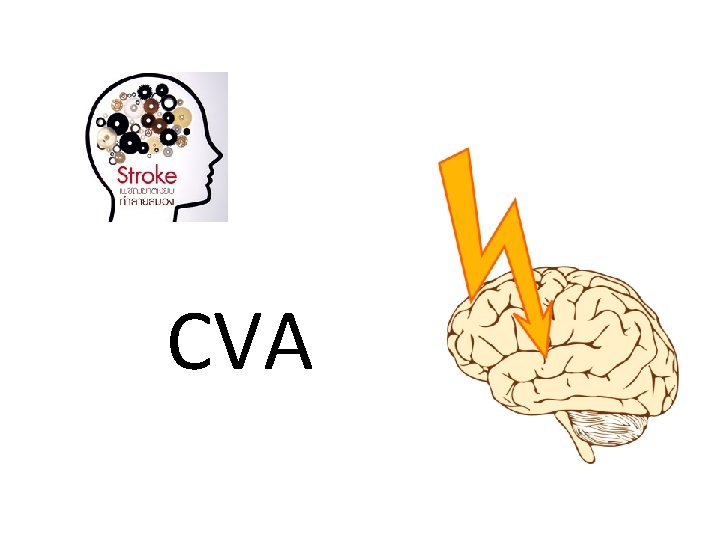 CVA 