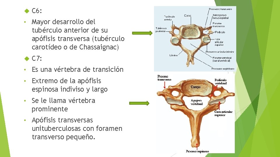  C 6: • Mayor desarrollo del tubérculo anterior de su apófisis transversa (tubérculo