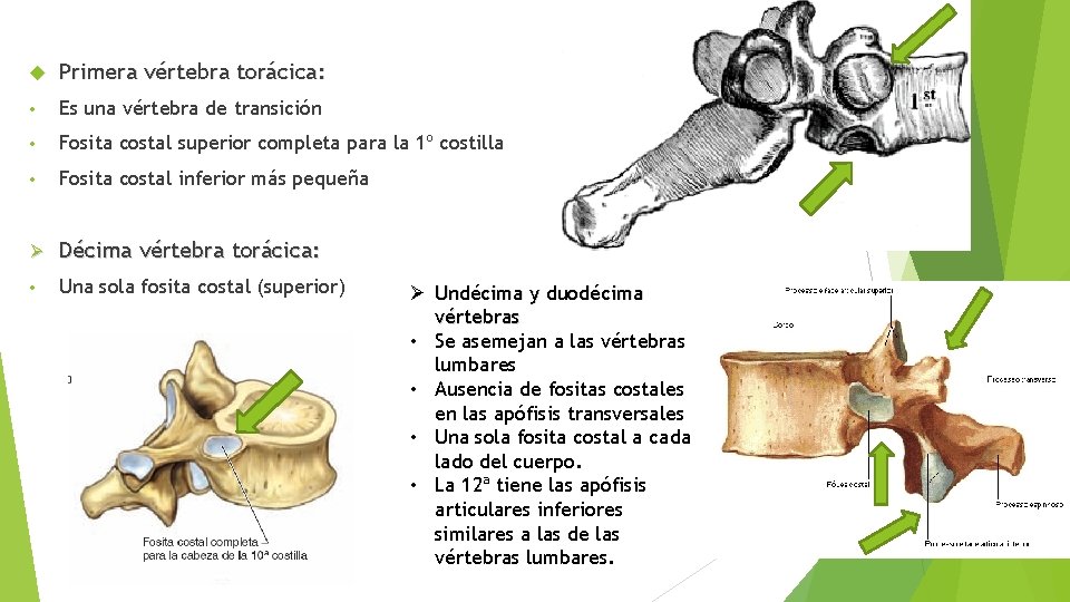  Primera vértebra torácica: • Es una vértebra de transición • Fosita costal superior