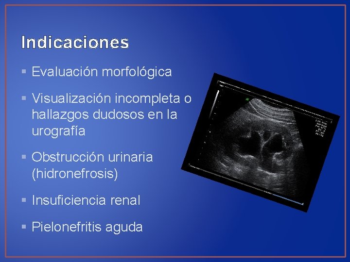 Indicaciones § Evaluación morfológica § Visualización incompleta o hallazgos dudosos en la urografía §