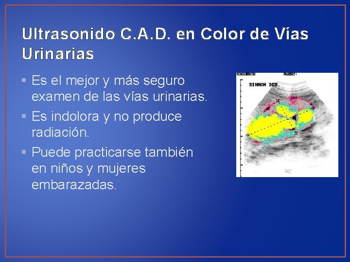 Ultrasonido C. A. D. en Color de Vías Urinarias § Es el mejor y