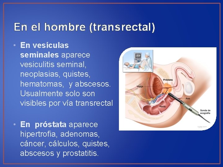 En el hombre (transrectal) • En vesículas seminales aparece vesiculitis seminal, neoplasias, quistes, hematomas,