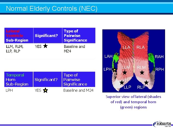 Normal Elderly Controls (NEC) Temporal Horn Sub-Region Significant? Type of Pairwise Significance LPH YES