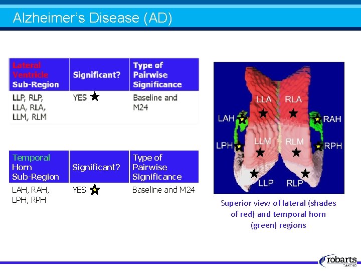 Alzheimer’s Disease (AD) Temporal Horn Sub-Region LAH, RAH, LPH, RPH Significant? Type of Pairwise