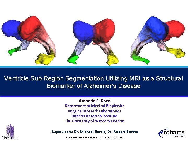 Ventricle Sub-Region Segmentation Utilizing MRI as a Structural Biomarker of Alzheimer’s Disease Amanda F.