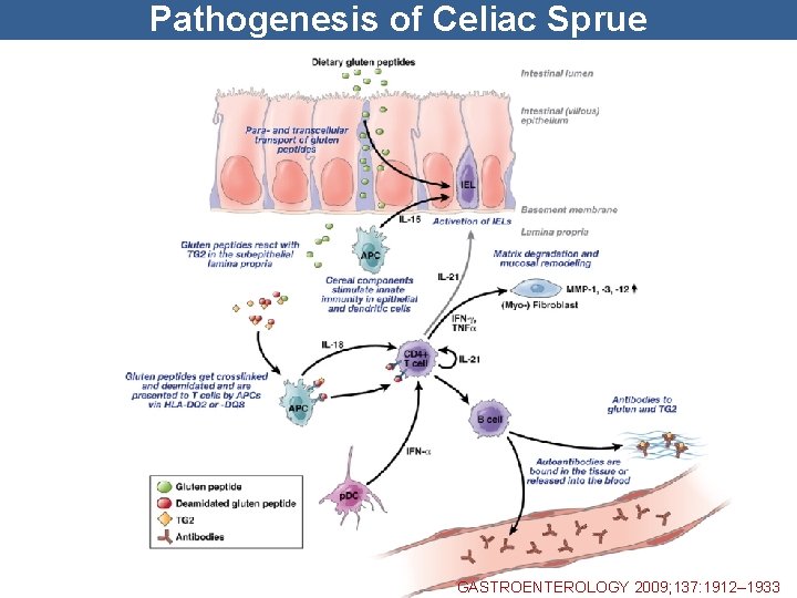 Pathogenesis of Celiac Sprue GASTROENTEROLOGY 2009; 137: 1912– 1933 