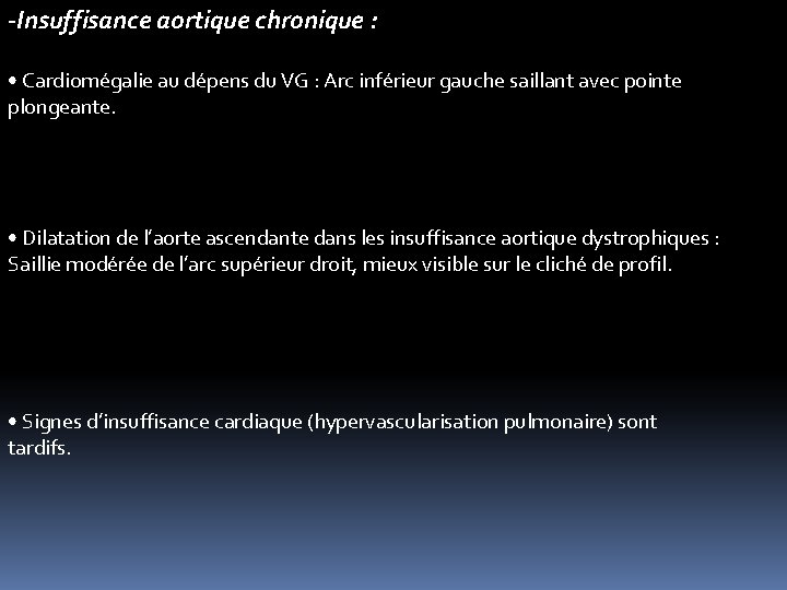 -Insuffisance aortique chronique : • Cardiomégalie au dépens du VG : Arc inférieur gauche