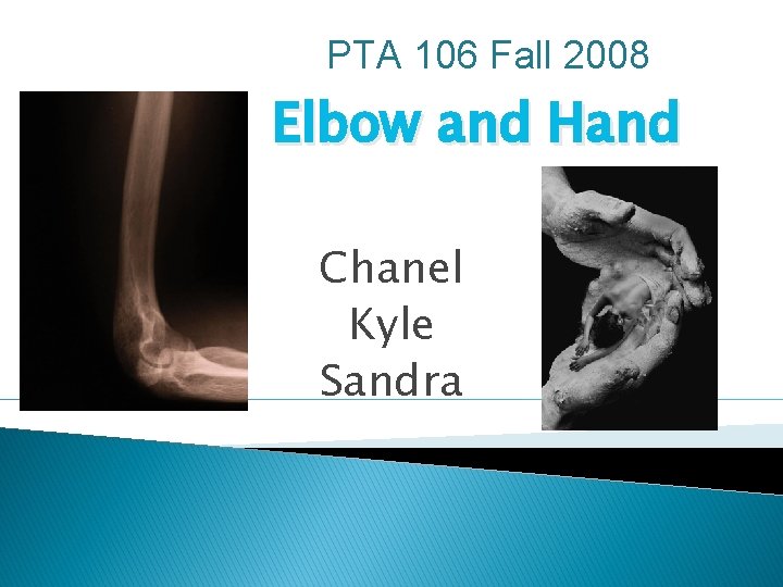 PTA 106 Fall 2008 Elbow and Hand Chanel Kyle Sandra 